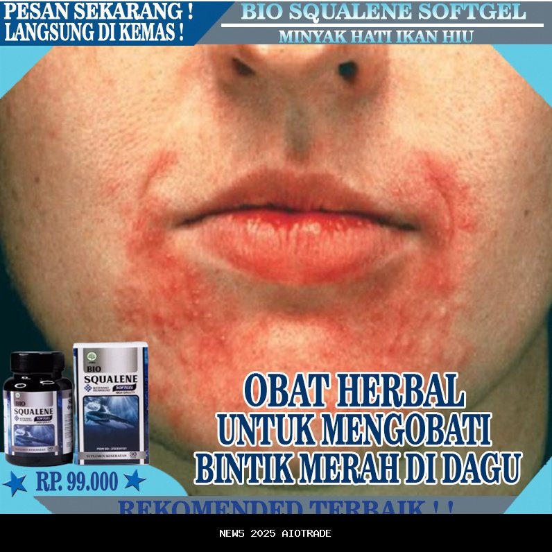 Kulit merah, bintik kecil, dan gatal: tanda iritasi pada anak?