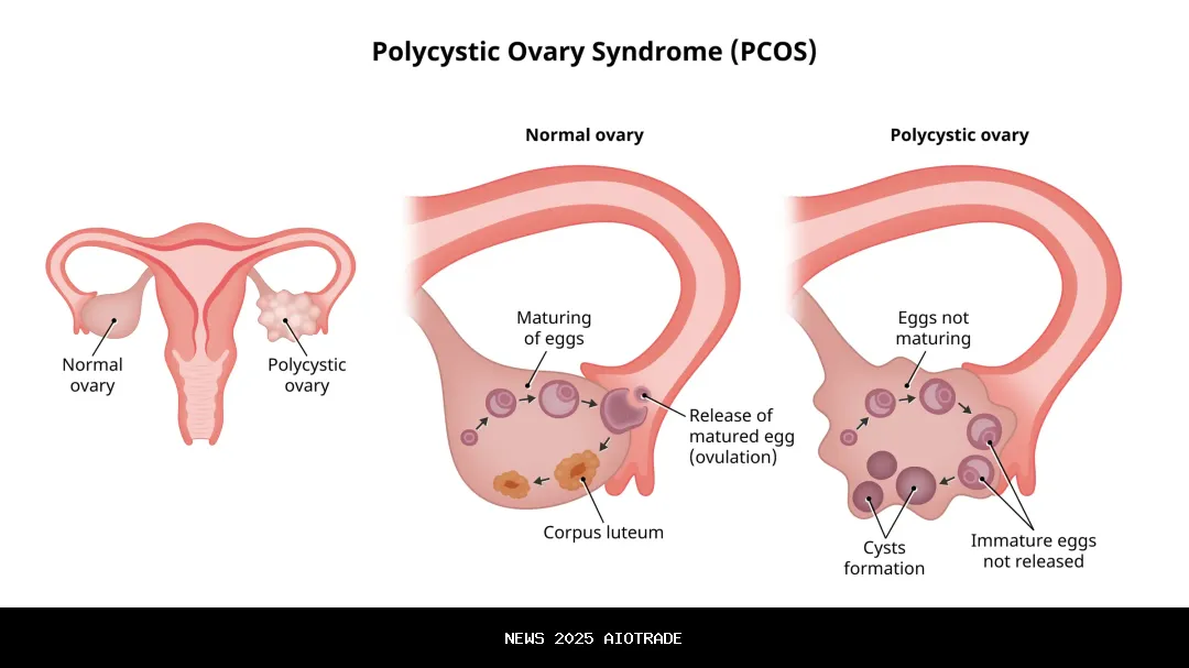 PCOS dan Keparentaan: Mengapa Kesuburan Tidak Berarti Mustahil