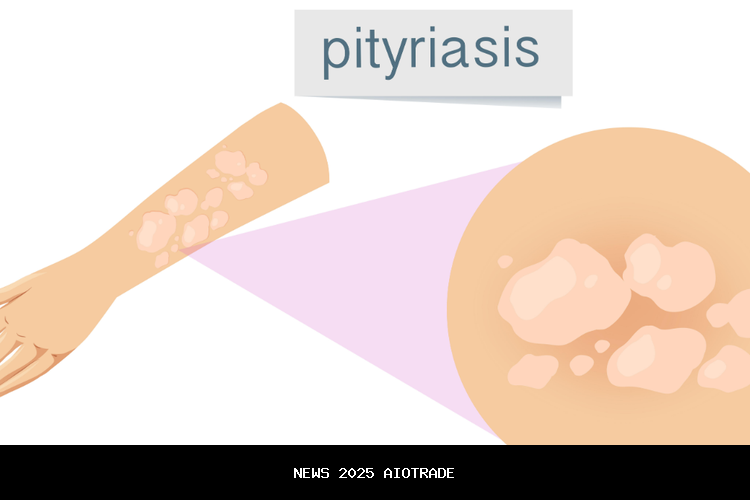Benarkah Mandi Saat Berkeringat Menyebabkan Panu? Ini Penjelasan Ilmiahnya