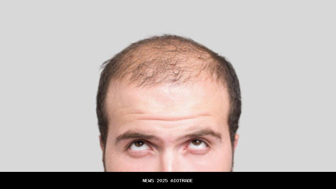 20 Serum Rambut BPOM untuk Cegah Kebotakan