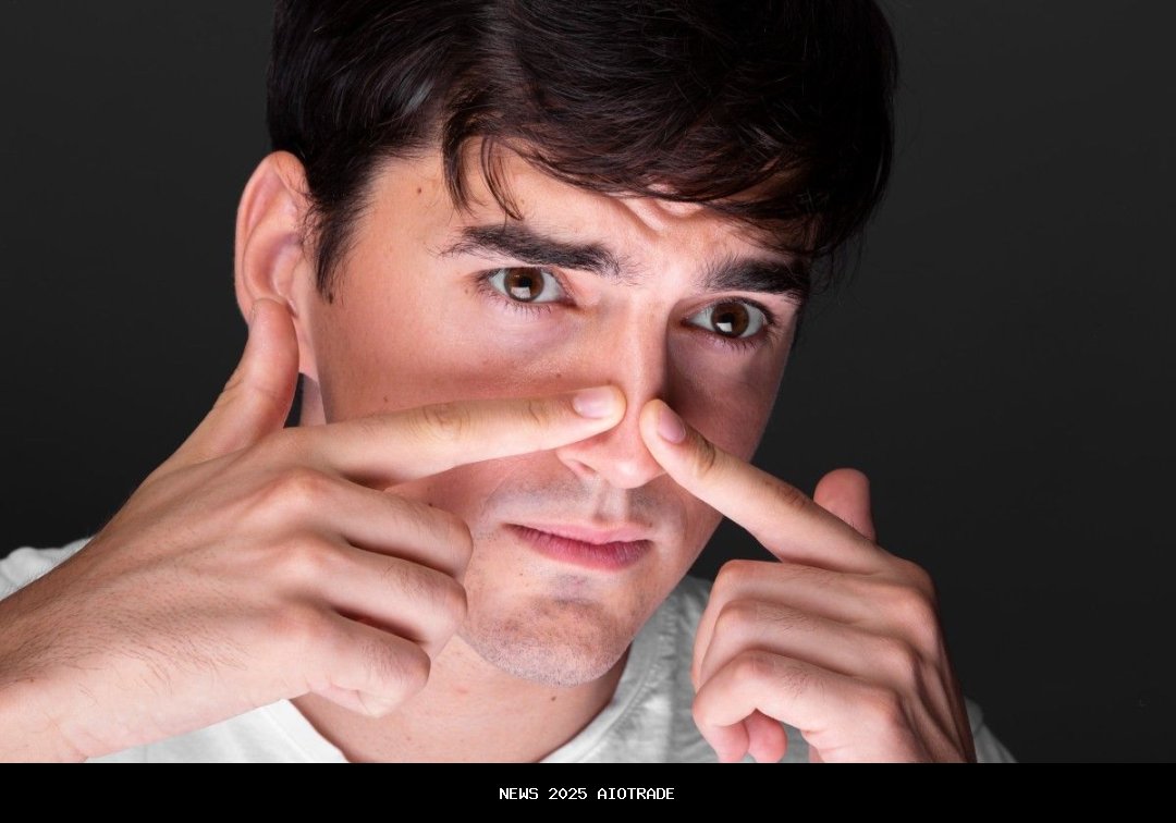 Ternyata Berbahaya! Ini Alasan Medis Mengapa Kamu Tidak Boleh Memencet Jerawat di 'Triangle of Death